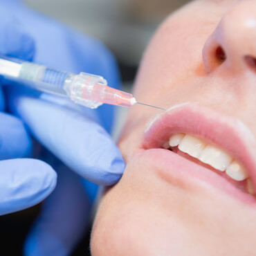 Fillerbehandlung mit Hyaluronsäure