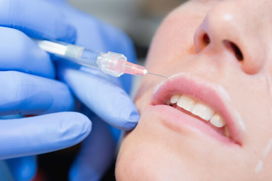 Fillerbehandlung mit Hyaluronsäure
